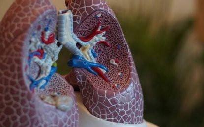 Hipertensión Arterial Pulmonar: ¿Qué es y a quiénes afecta más?